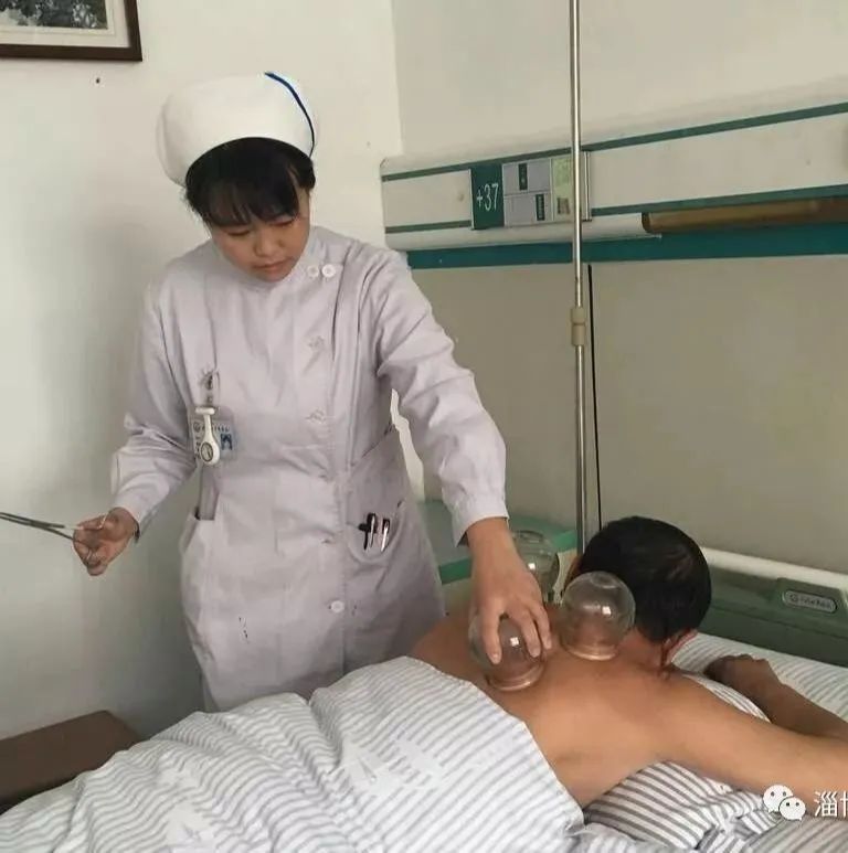 拔火罐